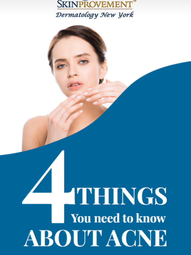 4 things you need to know about acne